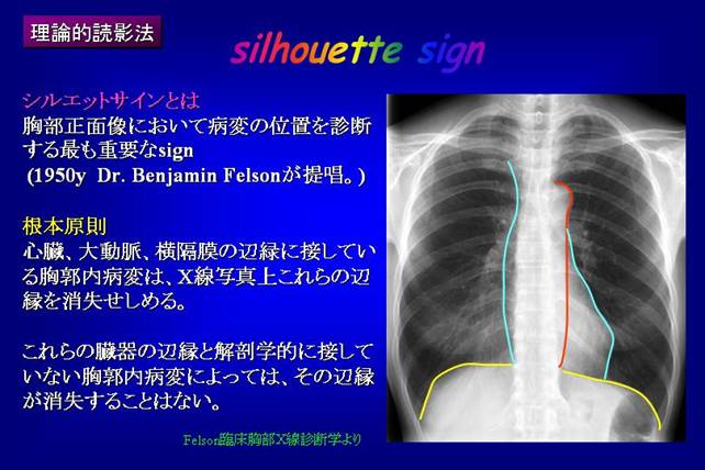 胸部単純写真の読み方