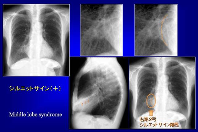 112D48 | medu4でゼロから丁寧に医学を学ぶ